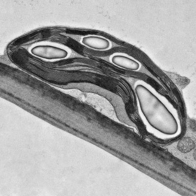 Elektronová mikroskopie čaruje v botanické zahradě